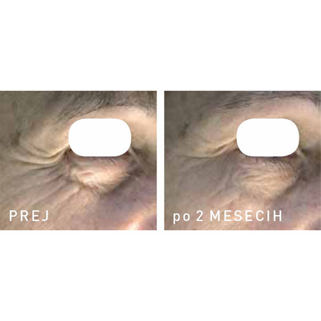 Afrodita 3PEPTIDES Tápláló krém száraz bőrtípusra Afrodita 3PEPTIDES Tápláló krém száraz bőrtípusra
