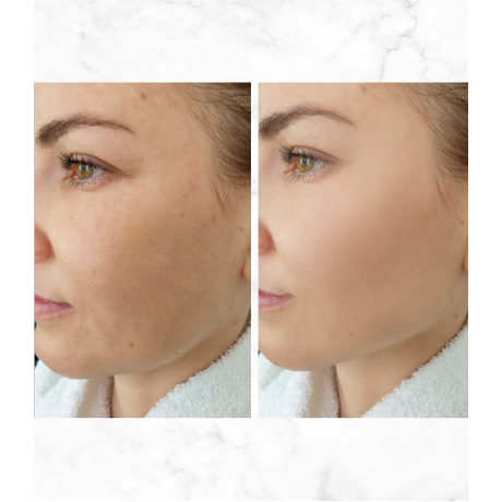 Afrodita BEAUTY FILLER SHOTS MULTIACTIVE Bakuchiol Phyto Retinol SHOT Afrodita BEAUTY FILLER SHOTS MULTIACTIVE Bakuchiol Phyto Retinol SHOT