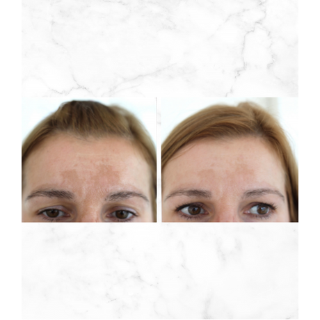 Afrodita BEAUTY FILLER SHOTS MULTIACTIVE C10 Vitamin SUPER SHOT