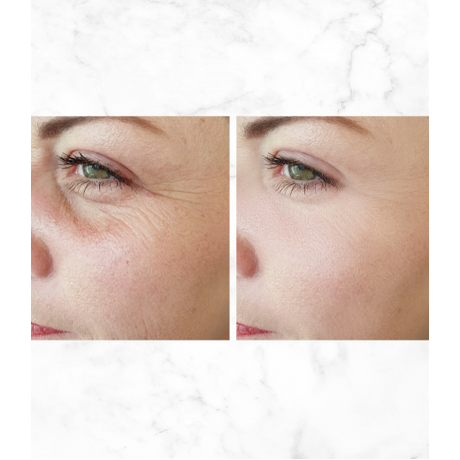 Afrodita BEAUTY FILLER SHOTS MULTIACTIVE Hyaluron & B5 BOOST SHOT