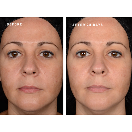 Afrodita BEAUTY FILLER SHOTS MULTIACTIVE INSTANT Oxygen POWER SHOT 2.0