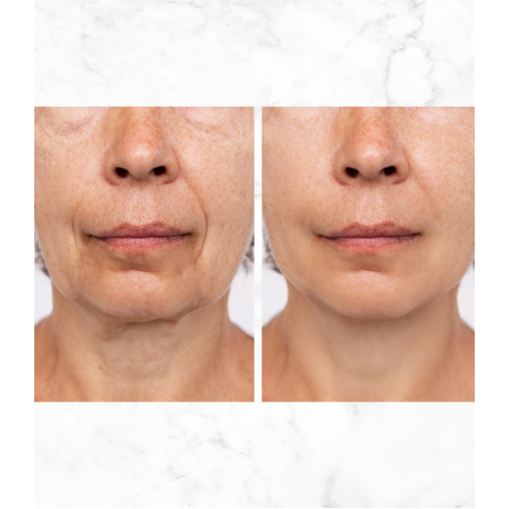 Afrodita BEAUTY FILLER SHOTS MULTIACTIVE Retinol SHOT